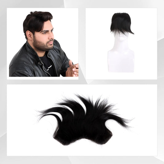 Hairs n You Superior FRONTAL Design | Ultra-Thin Frontline Hair Patch Hairs n You